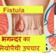 Homeopathic treatment for fistula
