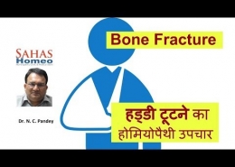 Homeopathic medicine for Bone fracture