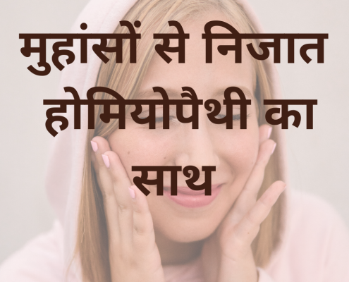 मुहासों से पाए निजात