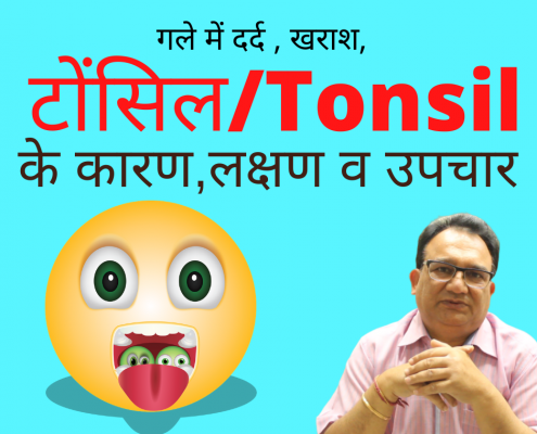 Tonsil treatment in homeoapthy
