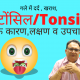 Tonsil treatment in homeoapthy