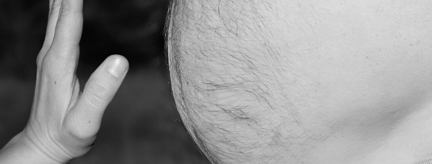 oesity treatment in homeoathu