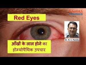 laal ankho ke lie homeopathic ucpahr