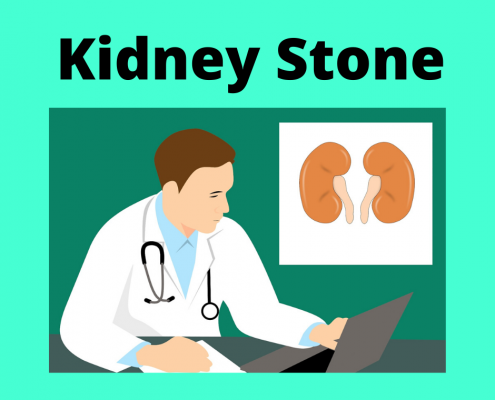 kidney stone treatment in homeoapthy